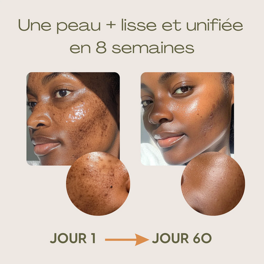 Curcuskin - pour un visage sans tâches ces vacances