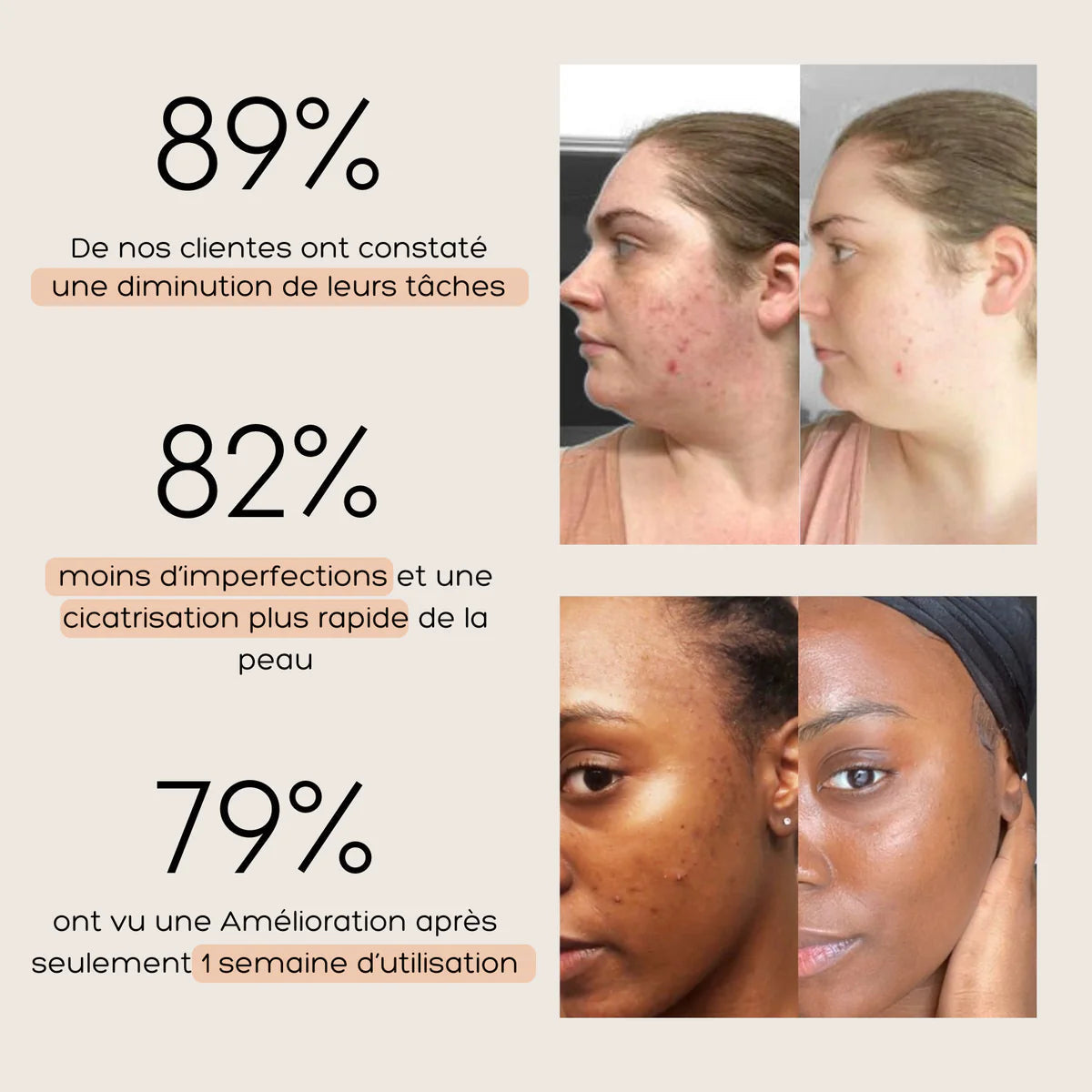 Curcuskin - pour un visage sans tâches ces vacances