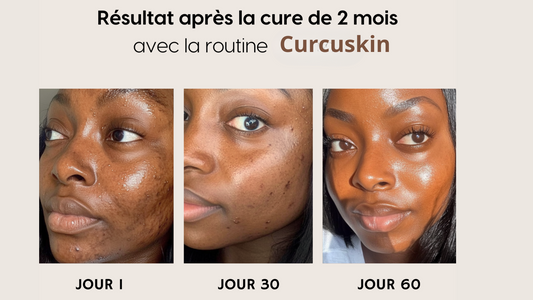 50 Pads Nettoyants au Curcuma 3 en 1 - Curcuskin care