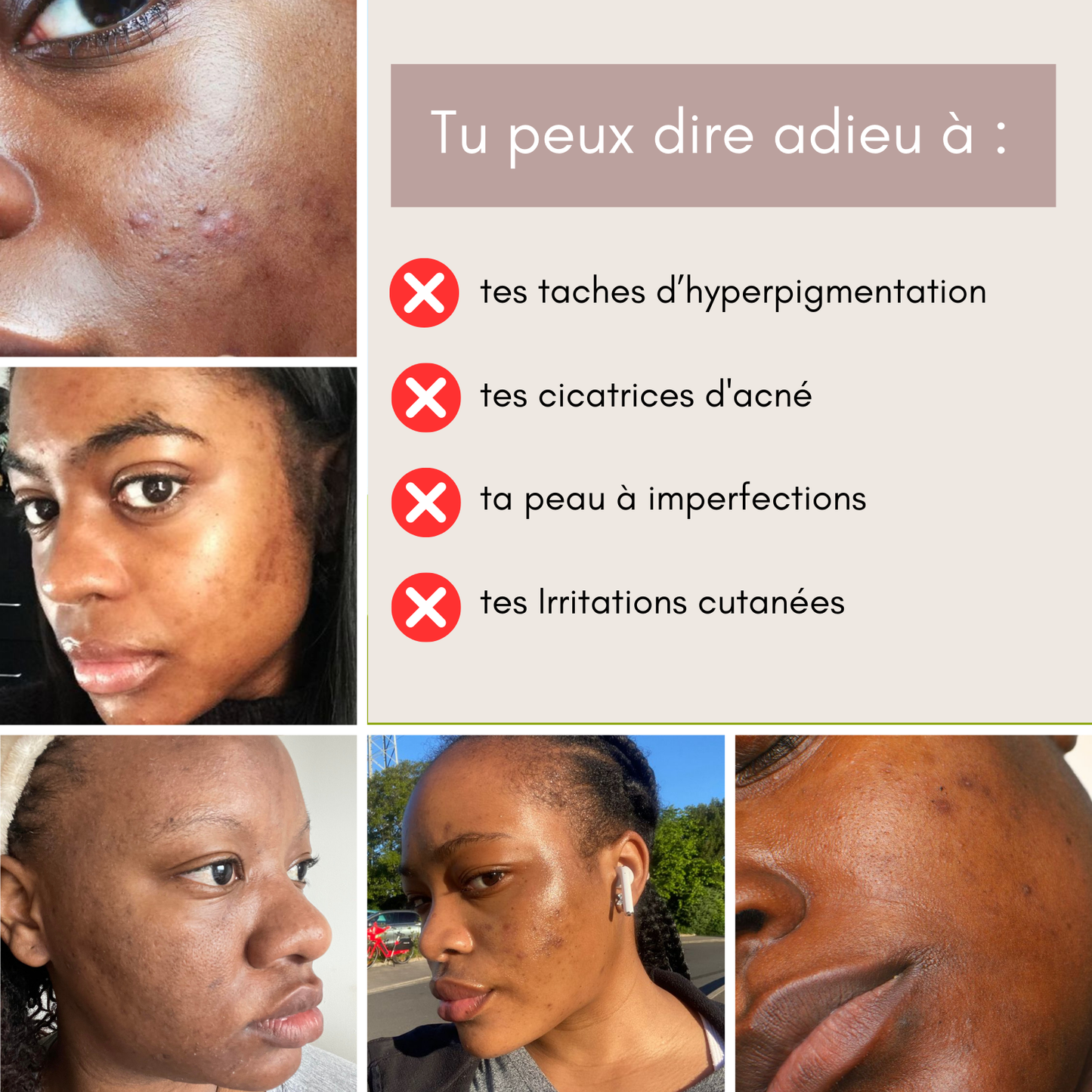 50 Pads Nettoyants au Curcuma 3 en 1 - Curcuskin care